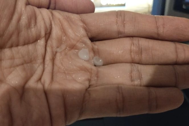 
 BMKG Jelaskan Penyebab Hujan Es di Tangerang dan Tangsel: Dipicu Awan Cumulonimbus